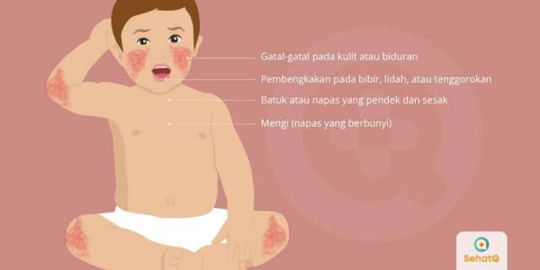 Kategori Gejala Alergi Susu Sapi pada Anak