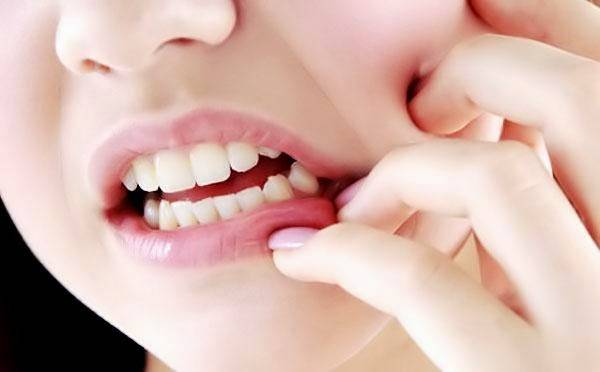 Cara Ampuh Mengatasi Gigi Ngilu | Rumah Sakit Umum Daerah