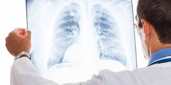 Penyakit paru-paru yang disebabkan oleh bakteri adalah